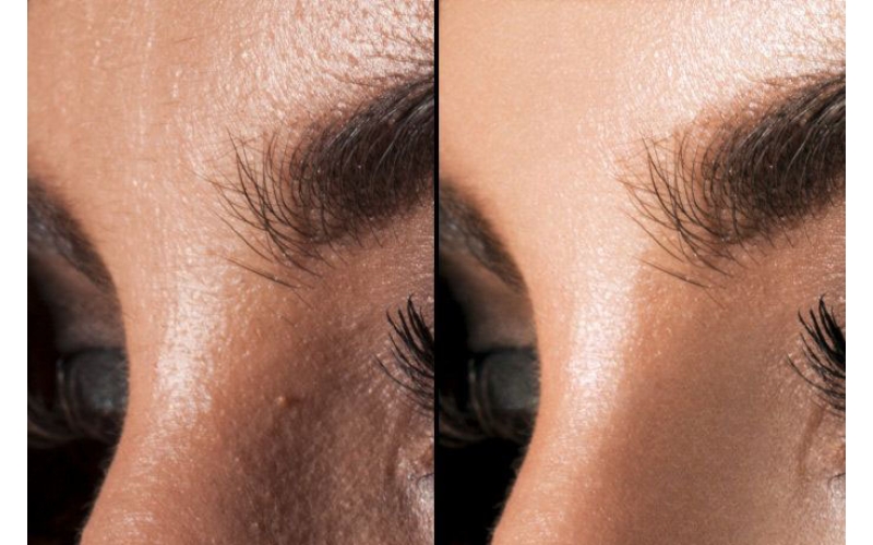 PS修圖實(shí)例Photoshop磨皮技術(shù)